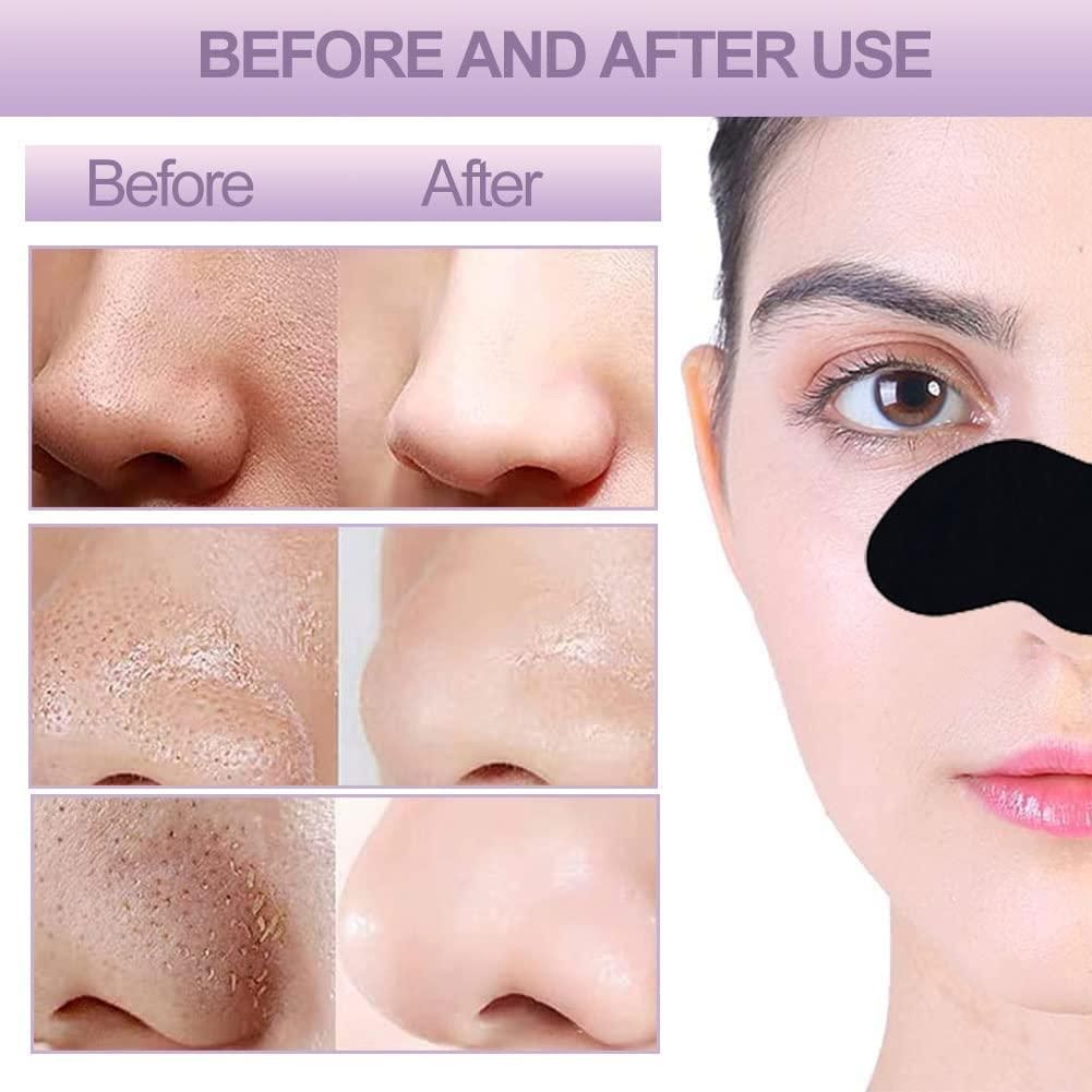 Deep Cleansing Blackhead Remover Strips (Pack of 10)