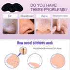 Deep Cleansing Blackhead Remover Strips (Pack of 10)