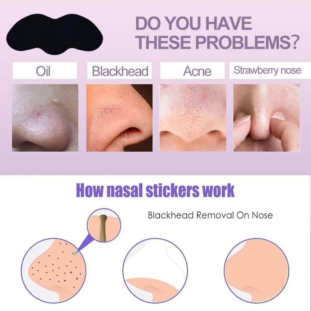 Deep Cleansing Blackhead Remover Strips (Pack of 10)