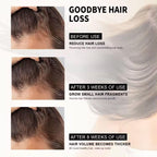 Hair Loss Treatment Serum 30Ml (Pack Of 1)